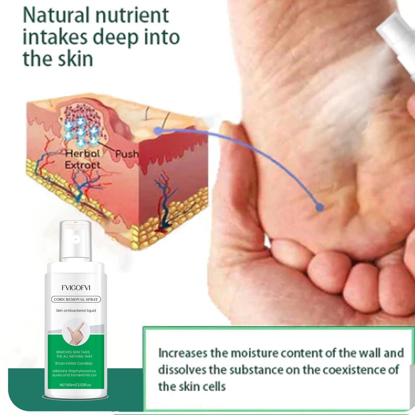 Corn Removal Spray 60ml Pack of 1