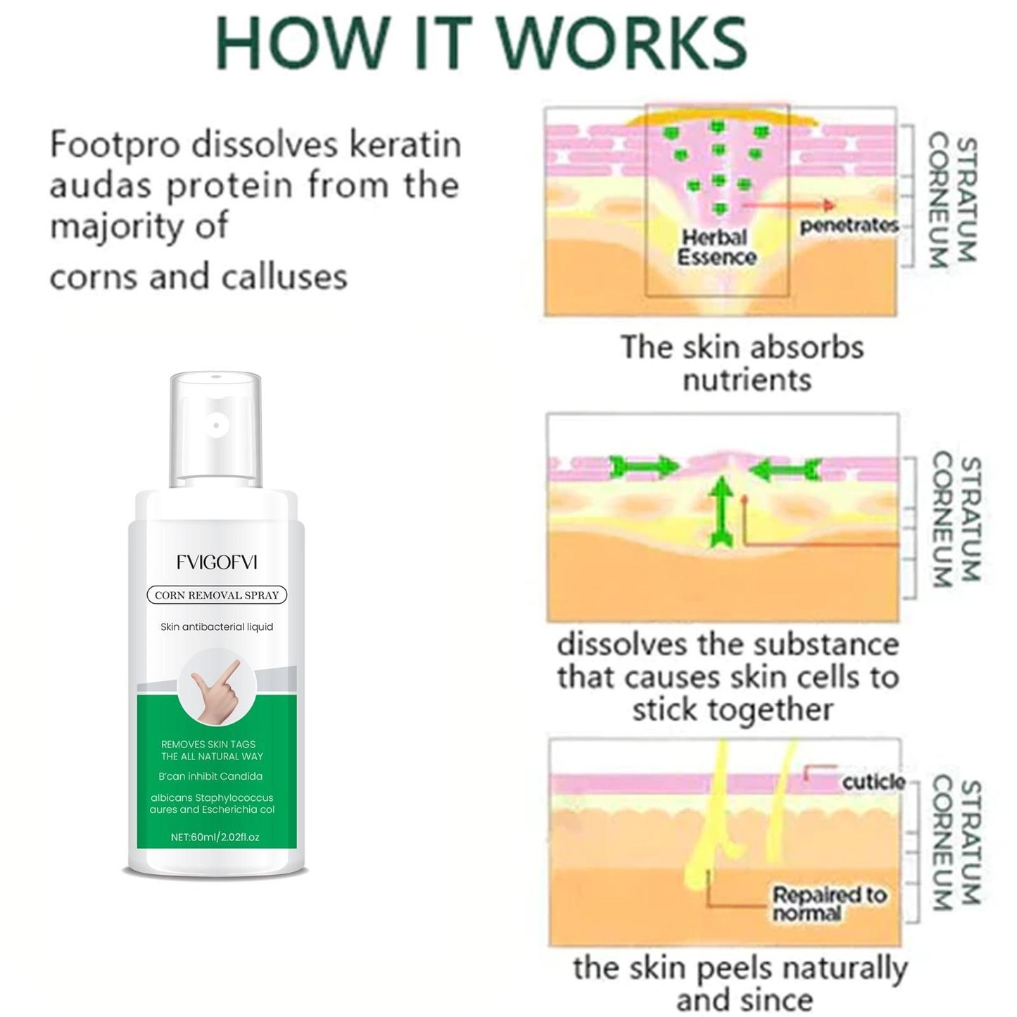 Corn Removal Spray 60ml Pack of 1